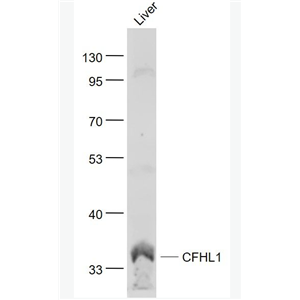 Anti-CFHL1 antibody-补体因子H相关蛋白1抗体