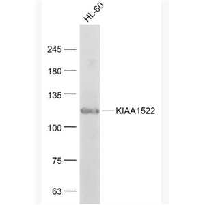 Anti-KIAA1522 antibody-KIAA1522蛋白抗体