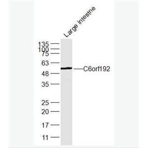 Anti-C6orf192 antibody-8号染色体开放阅读框192抗体