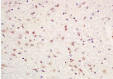 Anti-SETDB1/KMT1E antibody-组蛋白H3K9甲基转移酶4抗体,SETDB1/KMT1E