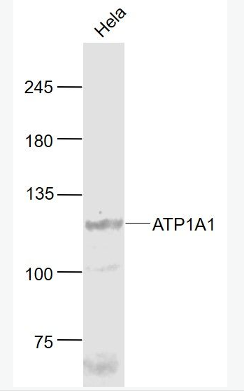 Anti-ATP1A1 antibody-Na+/K+-ATPase α1 钠钾ATP酶α1抗体,ATP1A1