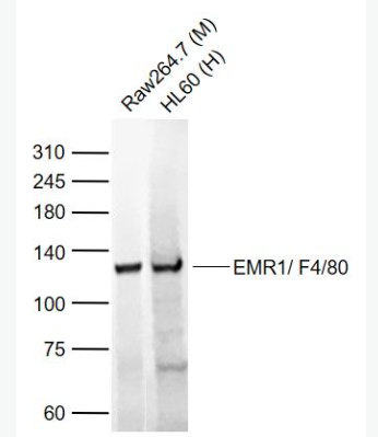 Anti-ADGRE1  antibody-表皮生长因子样激素受体1（EMR1）抗体,ADGRE1