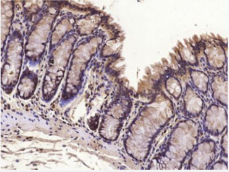 Anti-TCF12 antibody-转录因子12抗体,TCF12