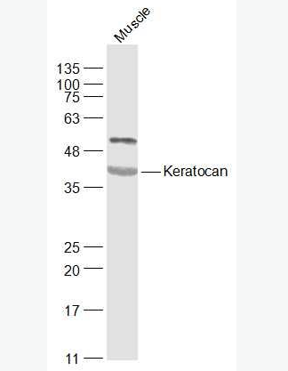 Anti-Keratocan antibody-细胞角膜蛋白多糖抗体,Keratocan