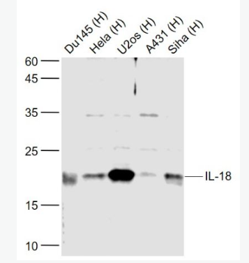 Anti-IL-18 antibody-白細(xì)胞介素18抗體,IL-18