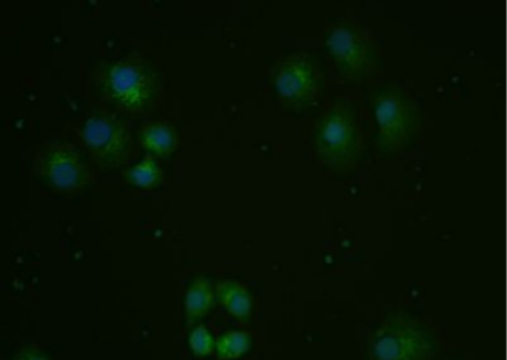 Anti-ox-LDL antibody-氧化低密度脂蛋白抗體,ox-LDL