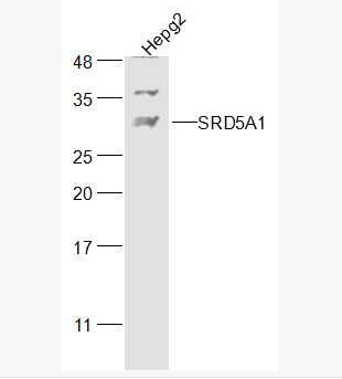 Anti-SRD5A1  antibody-类固醇5α还原酶1抗体,SRD5A1