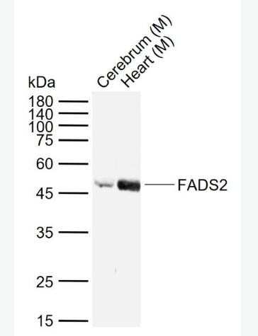 Anti-FADS2antibody-脂肪酸脱氢酶2抗体,FADS2