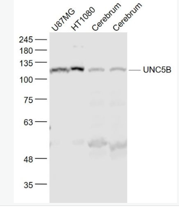 Anti-UNC5B  antibody-神經(jīng)突起誘導(dǎo)因子受體UNC5B抗體,UNC5B