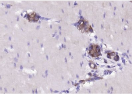 Anti-DUSP6 antibody-雙特異性蛋白磷酸酶6/絲裂原活化蛋白激酶磷酸酶3抗體,DUSP6