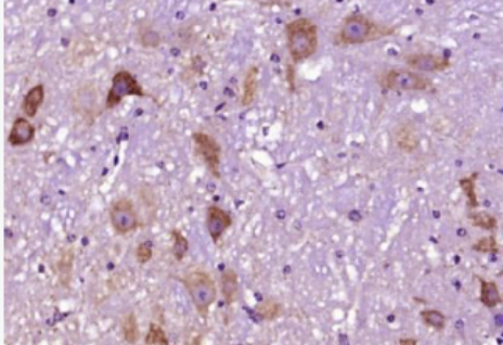 Anti-Syntaxin 13  antibody-神经突触素13抗体,Syntaxin 13