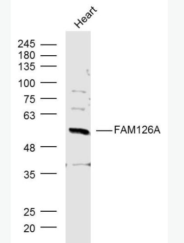 Anti-FAM126A antibody-髓鞘缺陷相关蛋白抗体,FAM126A