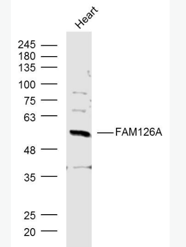 Anti-FAM126A antibody-髓鞘缺陷相關(guān)蛋白抗體,FAM126A