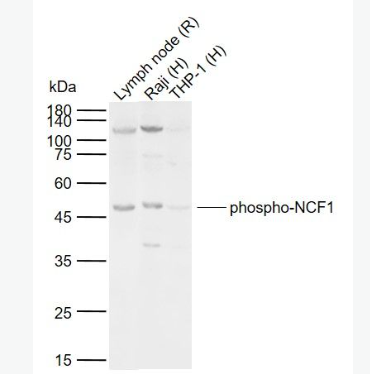 Anti-phospho-NCF1 (Ser359) antibody-磷酸化嗜中性粒细胞胞浆因子1抗体,phospho-NCF1 (Ser359)