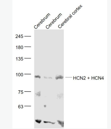 Anti-HCN2 + HCN4 antibody-環(huán)化核苷酸調(diào)控陽離子通道蛋白亞型2/4抗體,HCN2 + HCN4