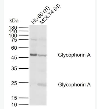 Anti-Glycophorin A antibody-血型糖蛋白A（CD235a）抗体,Glycophorin A