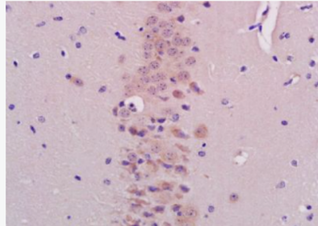 Anti-BHLHB9/p60TRP antibody-p60TRP蛋白抗體,BHLHB9/p60TRP