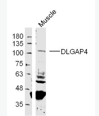 Anti-DLGAP4 antibody-PSD95结合蛋白4抗体,DLGAP4