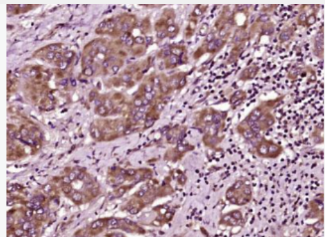 Anti-MAL2 antibody-T淋巴细胞分化蛋白MAL2抗体,MAL2