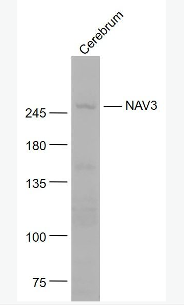 Anti-NAV3 antibody-神經(jīng)元引導(dǎo)蛋白3抗體,NAV3