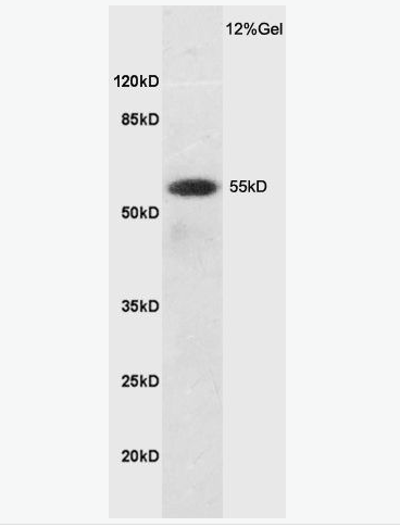 Anti-SLC7A5 antibody-CD98輕鏈抗體,SLC7A5