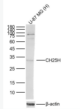 Anti-CH25H antibody-胆固醇25羟化酶抗体,CH25H