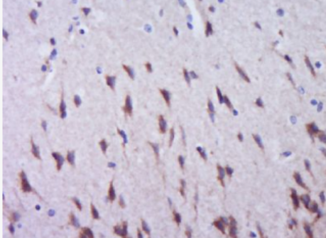 Anti-Phospho-ACACA (Ser79) antibody-磷酸化乙酰輔酶A羧化酶1ACCα抗體,Phospho-ACACA (Ser79)