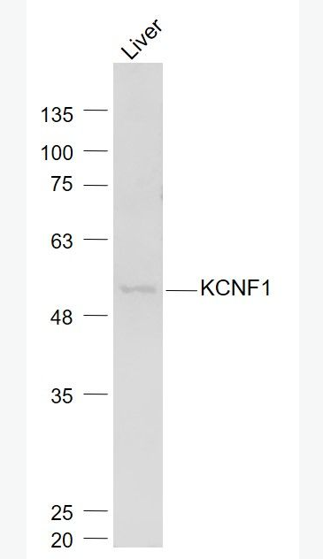 Anti-KCNF1 antibody-電壓門控性鉀通道蛋白亞基kv5.1抗體,KCNF1