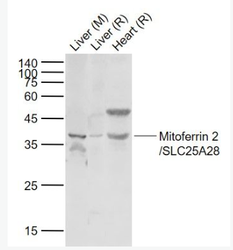 Anti-Mitoferrin 2/SLC25A28 antibody-线粒体铁转运蛋白2抗体,Mitoferrin 2/SLC25A28