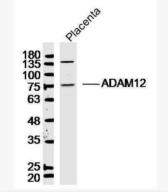 Anti-ADAM12 antibody-去整合素样金属蛋白酶12,ADAM12