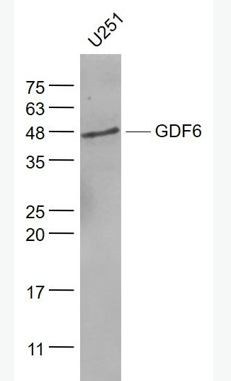 Anti-GDF6 antibody-生长分化因子6抗体,GDF6