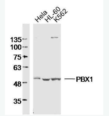 Anti-PBX1 antibody-B淋巴细胞白血病前体蛋白转录因子1抗体,PBX1