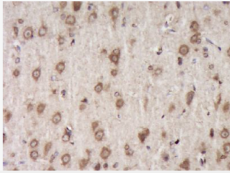 Anti-Fibromodulin antibody-纤维调节蛋白抗体,Fibromodulin