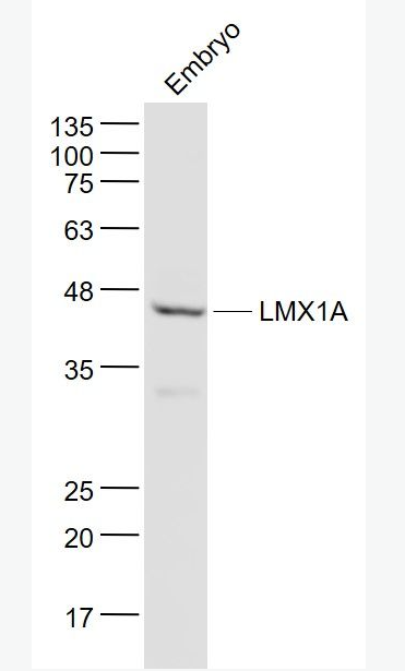 Anti-LMX1A antibody-同源盒转录因子LMX1A抗体,LMX1A