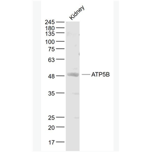 Anti-ATP5B antibody-ATP合成酶β5抗体,ATP5B