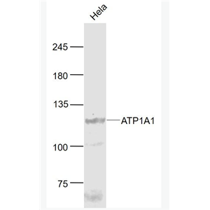 Anti-ATP1A1 antibody-Na+/K+-ATPase α1 钠钾ATP酶α1抗体