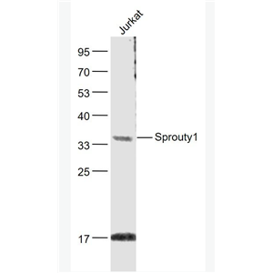 Anti-Sprouty1 antibody-软脂酰化磷蛋白Sprouty1抗体,Sprouty1