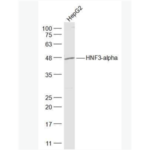 Anti-HNF3-alpha/FOXA1 antibody-转录因子HNF-3α/FOXA1抗体,HNF3-alpha/FOXA1