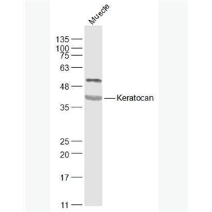 Anti-Keratocan antibody-细胞角膜蛋白多糖抗体
