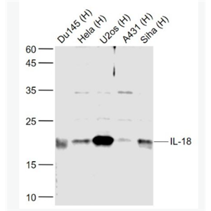 Anti-IL-18 antibody-白细胞介素18抗体