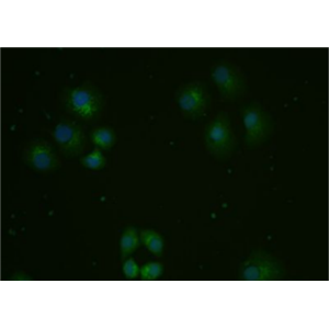 Anti-ox-LDL antibody-氧化低密度脂蛋白抗体