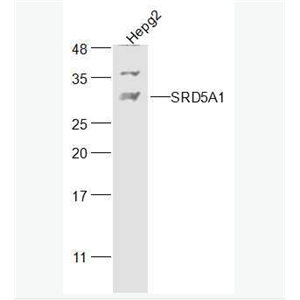 Anti-SRD5A1  antibody-类固醇5α还原酶1抗体
