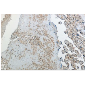 Anti-RTL8C antibody-反转录转座子Gag样蛋白8C抗体