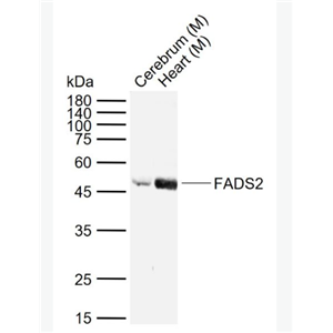 Anti-FADS2antibody-脂肪酸脱氢酶2抗体