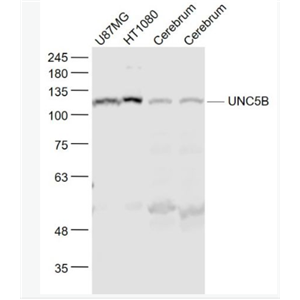 Anti-UNC5B  antibody-神經(jīng)突起誘導(dǎo)因子受體UNC5B抗體