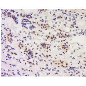 Anti-Calcipressin 1/DSCR 1 antibody-钙调神经磷酸酶调节蛋白1抗体（唐氏综合征候选区域蛋白1样蛋白1）