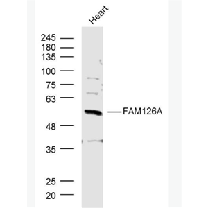 Anti-FAM126A antibody-髓鞘缺陷相关蛋白抗体,FAM126A