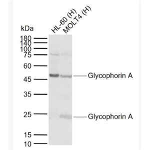 Anti-Glycophorin A antibody-血型糖蛋白A（CD235a）抗体