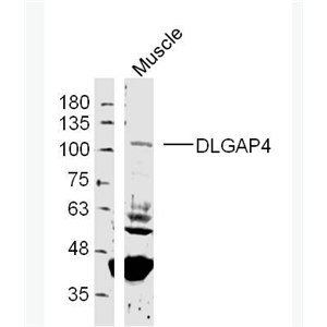 Anti-DLGAP4 antibody-PSD95结合蛋白4抗体,DLGAP4