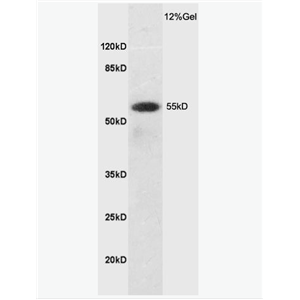 Anti-SLC7A5 antibody-CD98轻链抗体